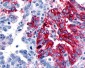 ADGRD1 / GPR133 Antibody (Cytoplasmic Domain)